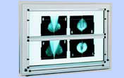negativoscopi per mammografia